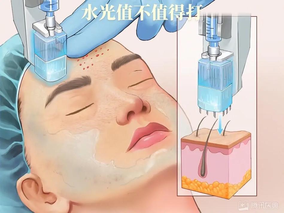 水光我来告诉你市面原理美业人(水光我来告诉你干细胞原理)