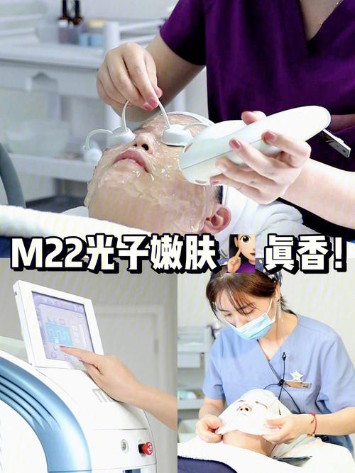 嫩肤光子皮肤科课堂项目医美小(光子嫩肤脉冲支队所得)