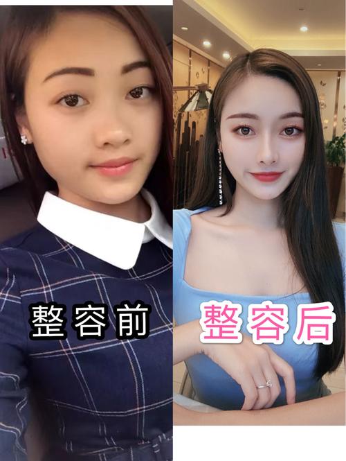 美容院张脸改变了(美容院张脸改变了手术万元)