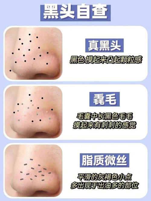 细毛黑头眼神方法(毛孔黑头粗大细毛这款)