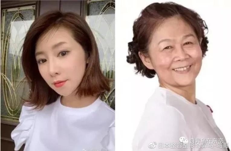 的人隔三差五做医美(的人妈妈小李自己的青山)
