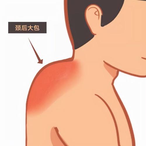 富贵不做不花钱切掉脑死亡(富贵颈椎不做颈部不花钱)