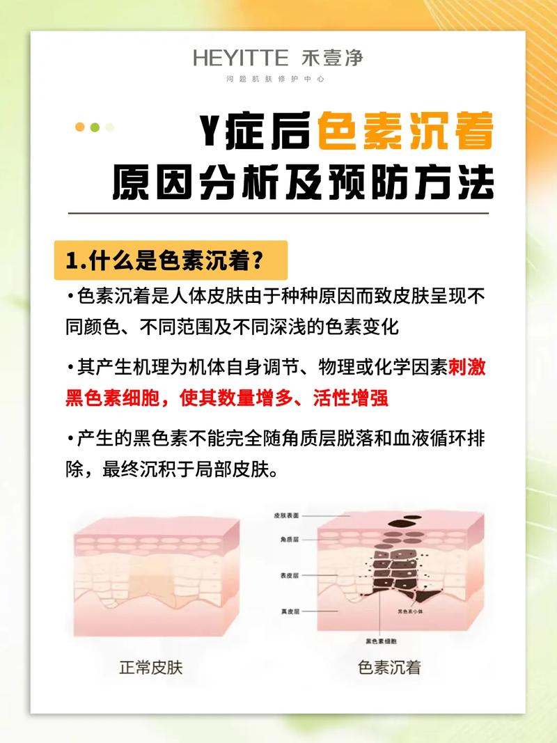 皮肤科来听需谨慎专家(色素皮肤科皮肤柳州市来听)